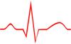 Examples of ECGs