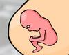 Life expectancy 1.0