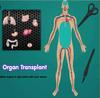 Organ Transplant